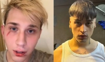 El streamer Brunenger denunció que Tiago PZK lo molió a golpes y el cantante se defendió