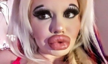 Tiene 22 años y quiere tener "los labios más grandes del mundo"