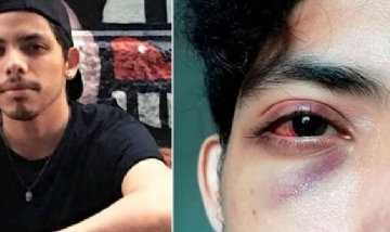 Una patota atacó a patadas a una pareja gay