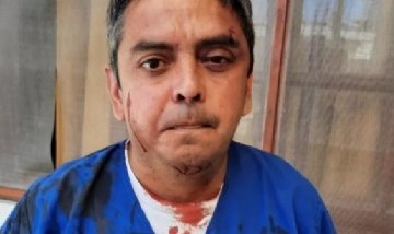 Golpeó al secretario de Salud de General Lavalle por contagiarse de coronavirus