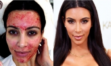 Los tratamientos de belleza más costosos y bizarros de las estrellas de Hollywood