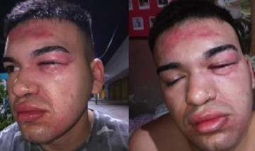 El aterrador relato de un joven que fue agredido brutalmente por patovicas a la salida de un boliche