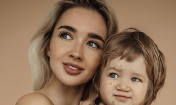 Influencer visibilizó la extraña enfermedad que padece su hijo
