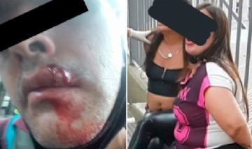 ¡Horror!: un policía les pidió a dos mujeres que se pusieran el barbijo y lo enviaron al hospital