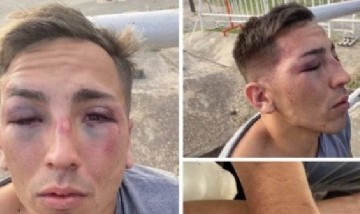 Un joven denunció una brutal golpiza de patovicas en un reconocido boliche de la Costanera porteña