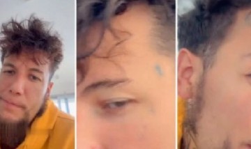 Alex Caniggia se hizo un impactante retoque en la cara y sorprendió a todos: "Es de villeros..."