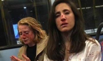 Ataque homofóbico contra azafata uruguaya y su novia en un autobús