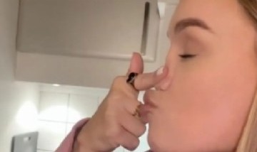 Una mujer no tiene hueso ni cartílago en la nariz y se hizo viral en redes sociales