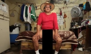 El hombre con el pene más largo del mundo sufre problemas de salud por su condición