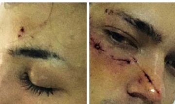 Dos jóvenes fueron brutalmente agredidos en nuevo ataque homofóbico en Palermo