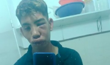 Brutal golpiza entre cuatro personas a un chico de Casilda: "La estoy contando de milagro"