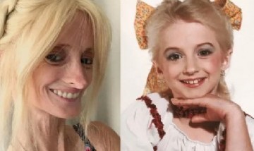 Viral: mujer sufre extraña enfermedad que la hace envejecer 8 veces más rápido