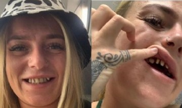 Se burlaban de sus dientes en redes sociales pero una invitación cambió su vida