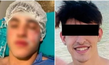 Una locura: Con una botella rota le cortó la cara a su amigo porque hablaba con su ex