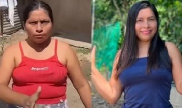 La influencer Lis Padilla de "Amores que matan" cambió radicalmente tras pasar por el quirófano