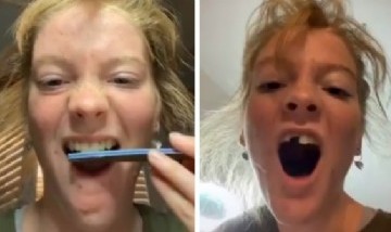 Nueva y peligrosa tendencia en TikTok: se liman los dientes para "emparejarlos"