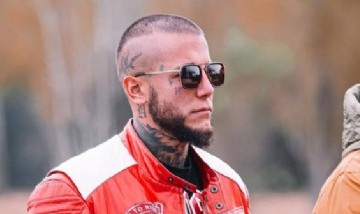El cambio de Alex Caniggia tras un retoque facial