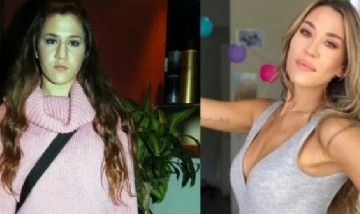 Jimena Barón habló de sus cirugías estéticas y cómo cambió su cuerpo: "Me pelé el lomo"