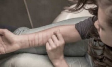 Impactante: una adolescente se cortó el brazo para cumplir un desafío de TikTok