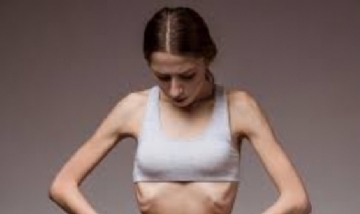 Deterioro cognitivo, desnutrición severa y pérdida de la masa ósea: así afectan la bulimia y la anorexia a la salud