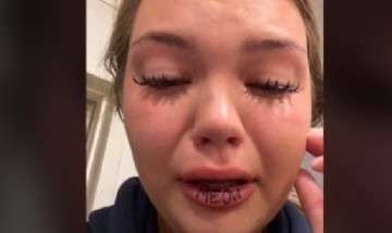 ¡Ahí no! Se hizo un tatuaje en los labios y rompió en llanto al ver como le quedó