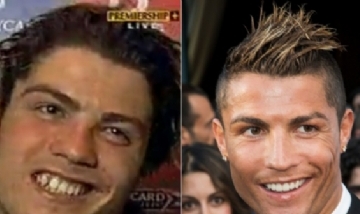 Revelan las cirugías plásticas que se hizo Cristiano Ronaldo