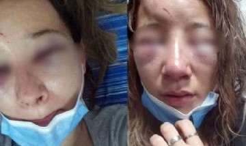 Dos mujeres atacaron a una chica a la salida de un boliche, la desfiguraron y le arrancaron las uñas