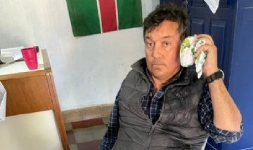 Escándalo en Santa Fe: un intendente golpeó brutalmente al cuñado de José Luis Espert