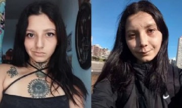 Una joven de 23 años se desfiguró la cara en un accidente en rollers y mostró su recuperación