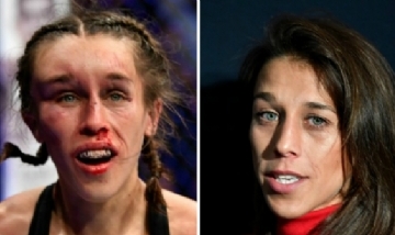 ¡Irreconocible! El antes y el después del rostro de una peleadora de UFC