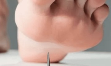 Una mujer recibió 10 millones de dólares después de pisar un clavo oxidado en un supermercado