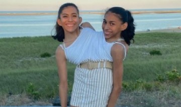 Una de las siamesas mexicanas tiene novio y reveló el acuerdo íntimo al que llegó con su hermana