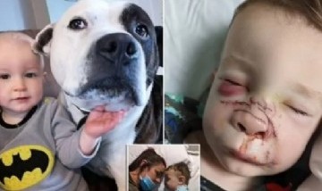 Un bull terrier le desfiguró la cara a un niño y los padres advierten sobre ciertas razas de perros