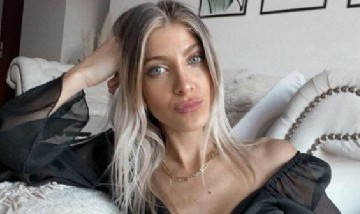 ¿Qué se hizo? Cande Ruggeri sorprendió a todos con su nuevo rostro