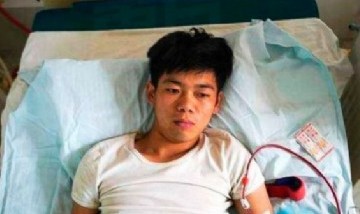 Adolescente vende su riñón para comprar un IPhone y ahora necesitará diálisis para siempre