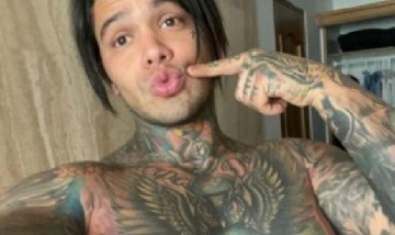 ¡Increíble! Un influencer colombiano perdió una apuesta y se realizó un implante de senos