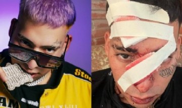 Kaleb Di Masi mostró fotos de su recuperación tras el grave accidente que casi lo mata