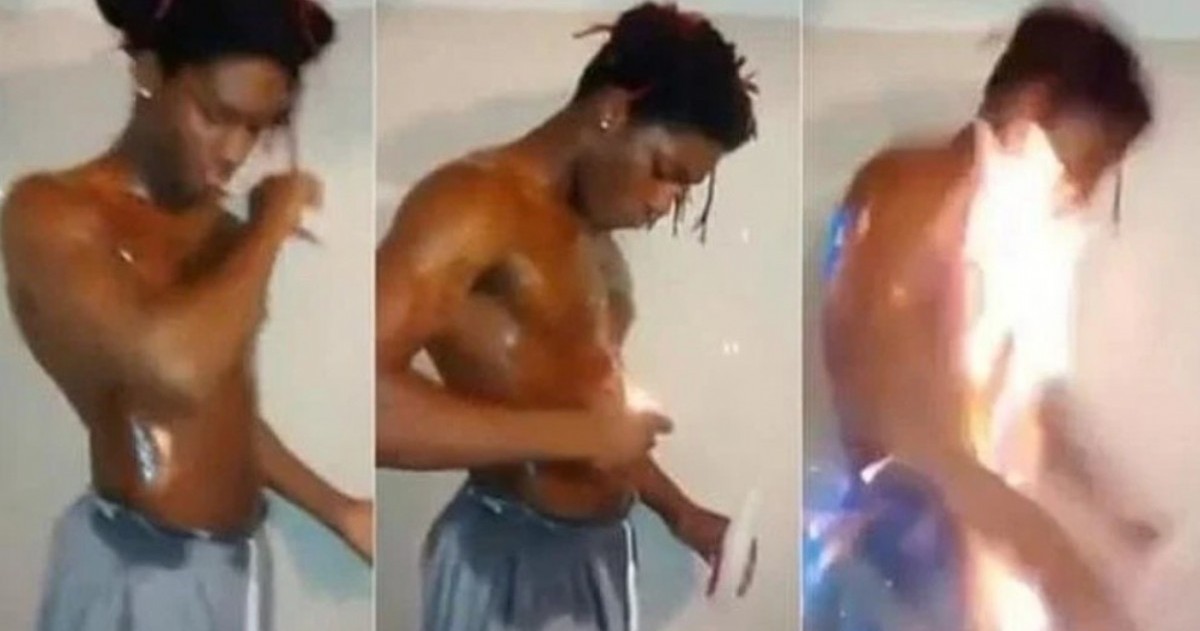 Se trata del “Fire Challenge”, un desafío que impulsa a adolescentes a rociarse con alcohol y encenderse frente a cámara. Médicos y especialistas advierten por quemaduras graves y falta de acompañamiento adulto.