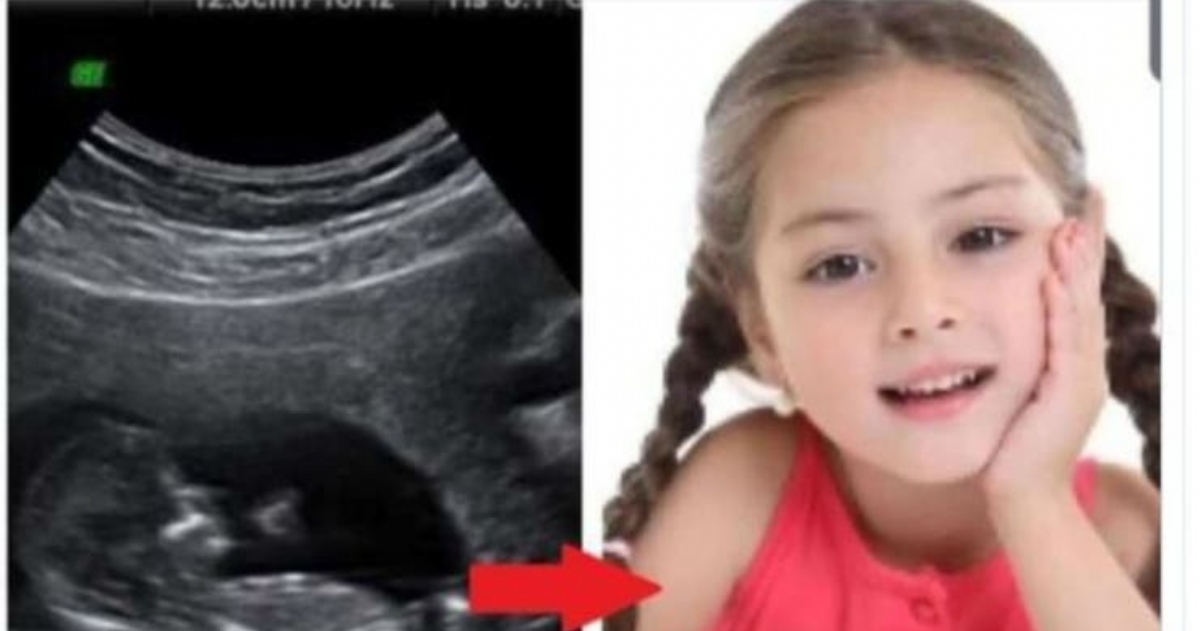 El meme que publicó hace referencia a la FaceApp