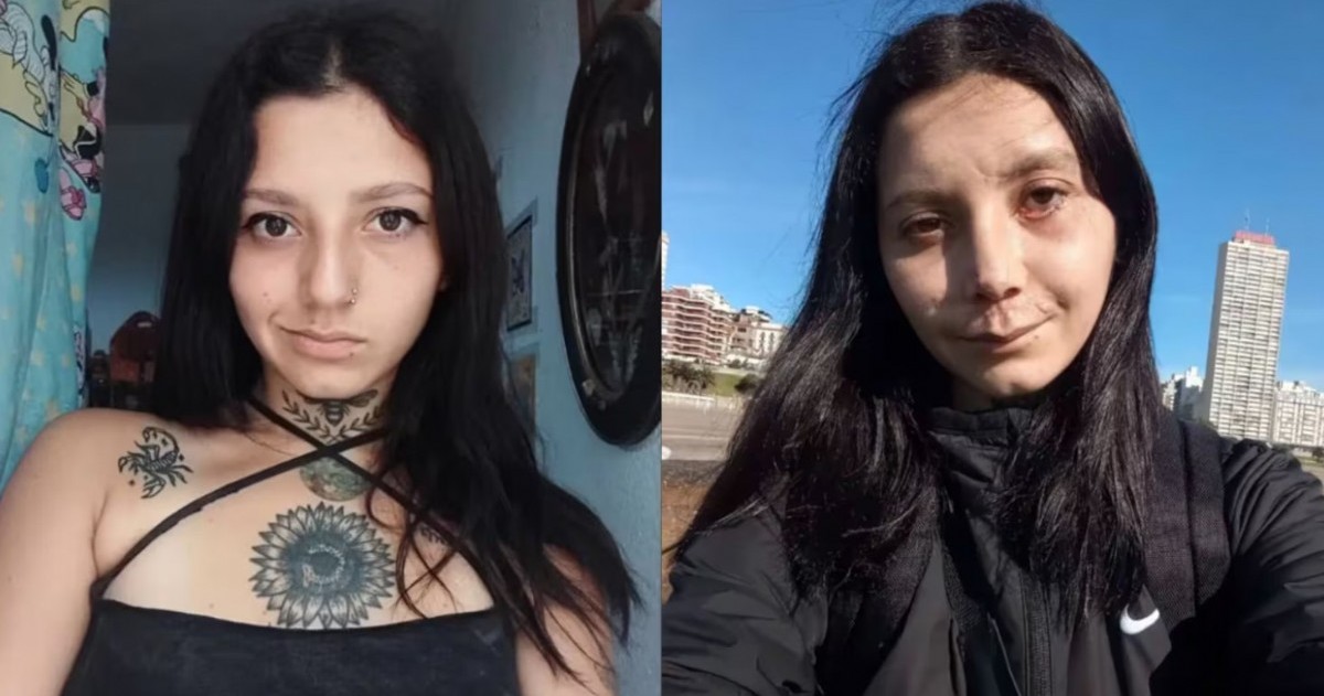 Sol Gari chocó contra un auto mientras patinaba por la costa y atravesó múltiples cirugías. Decidió registrar todo el proceso y hoy acompaña a otras personas desde sus redes.