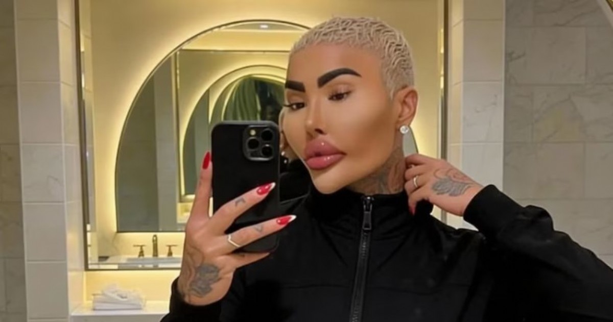 El británico de 34 años fue hallado sin vida y la policía analiza si un tratamiento cosmético reciente pudo estar vinculado a su fallecimiento. Hay dos detenidos por homicidio involuntario.